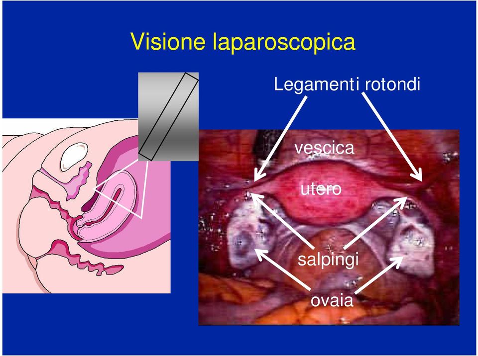 Legamenti