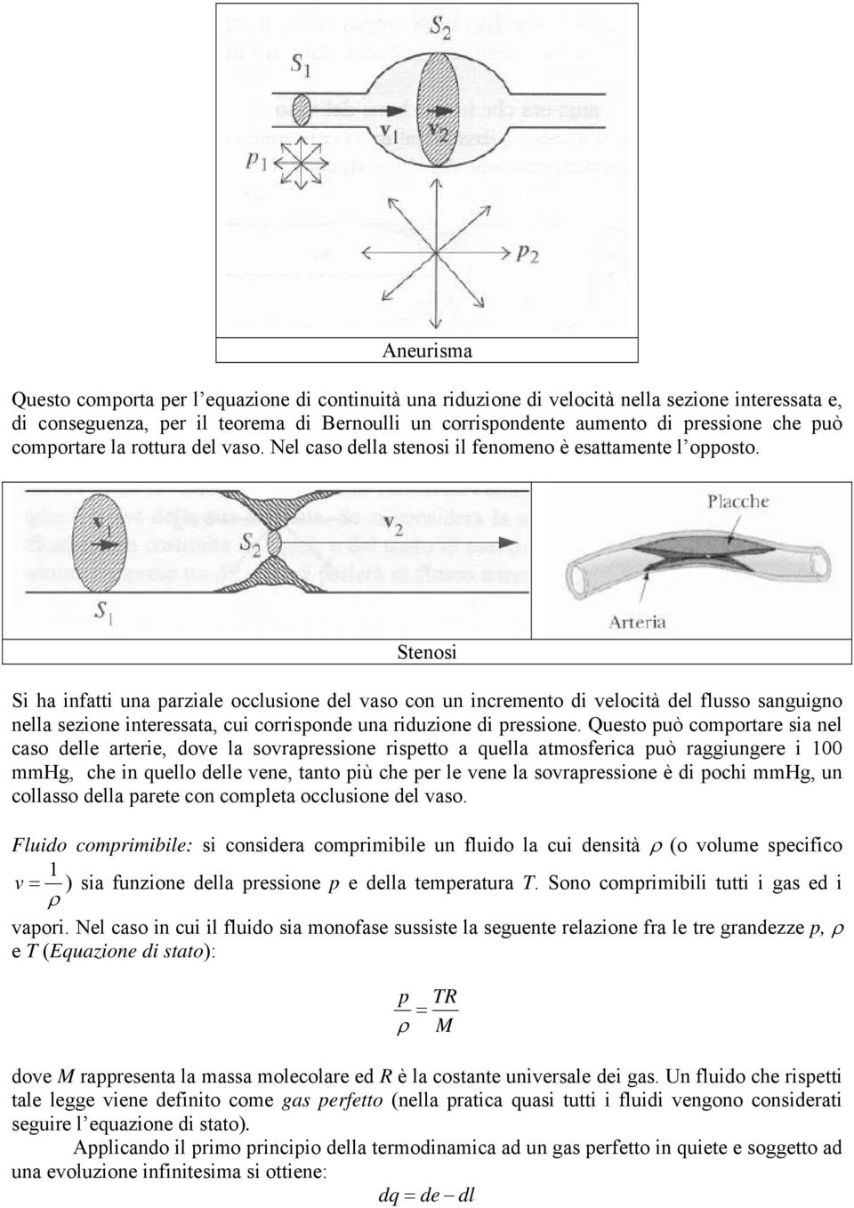 Stenosi Si ha infatti una arziale occlusione del vaso con un incremento di velocità del flusso sanguigno nella sezione interessata, cui corrisonde una riduzione di ressione.