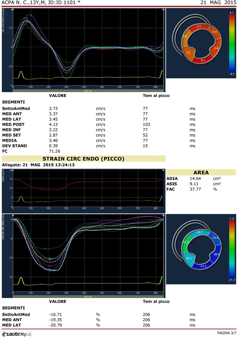 87 cm/s 52 ms MEDIA 3.46 cm/s 77 ms DEV STAND 0.