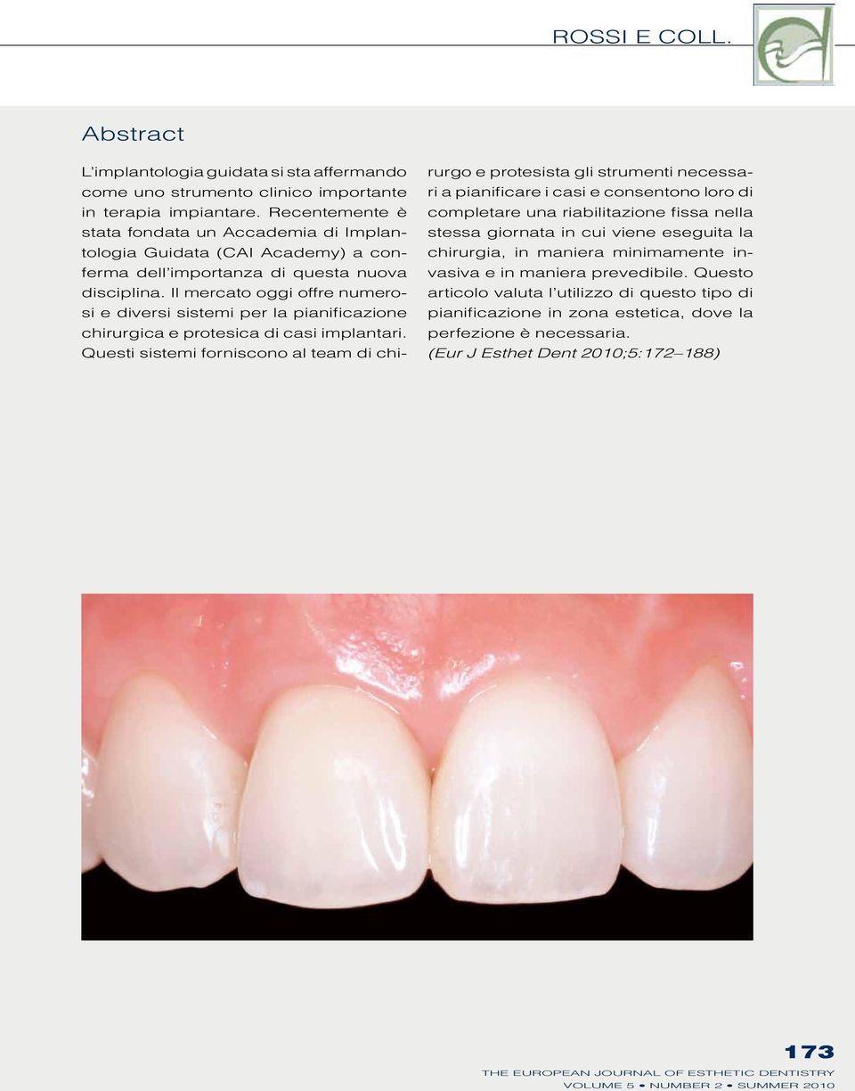 Il mercato oggi offre numerosi e diversi sistemi per la pianificazione chirurgica e protesica di casi implantari.