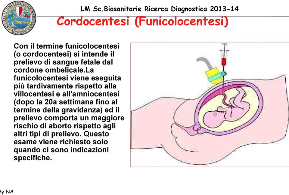 la funicolocentesi viene eseguita più tardivamente rispetto alla villocentesi e all'amniocentesi (dopo la 20a