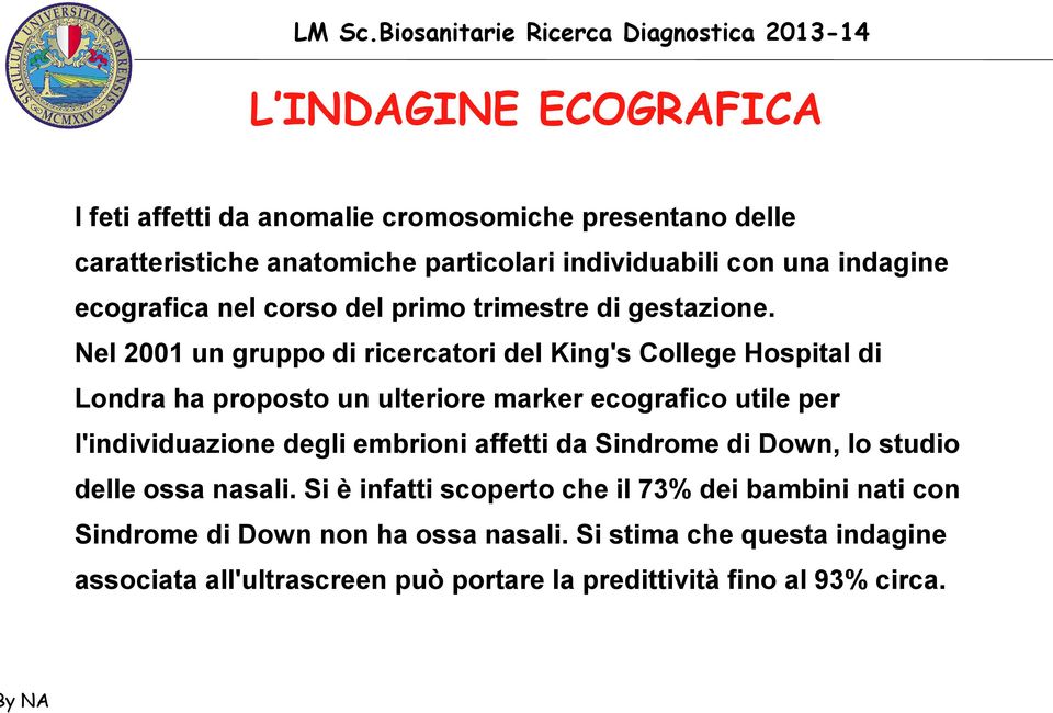 Nel 2001 un gruppo di ricercatori del King's College Hospital di Londra ha proposto un ulteriore marker ecografico utile per l'individuazione degli