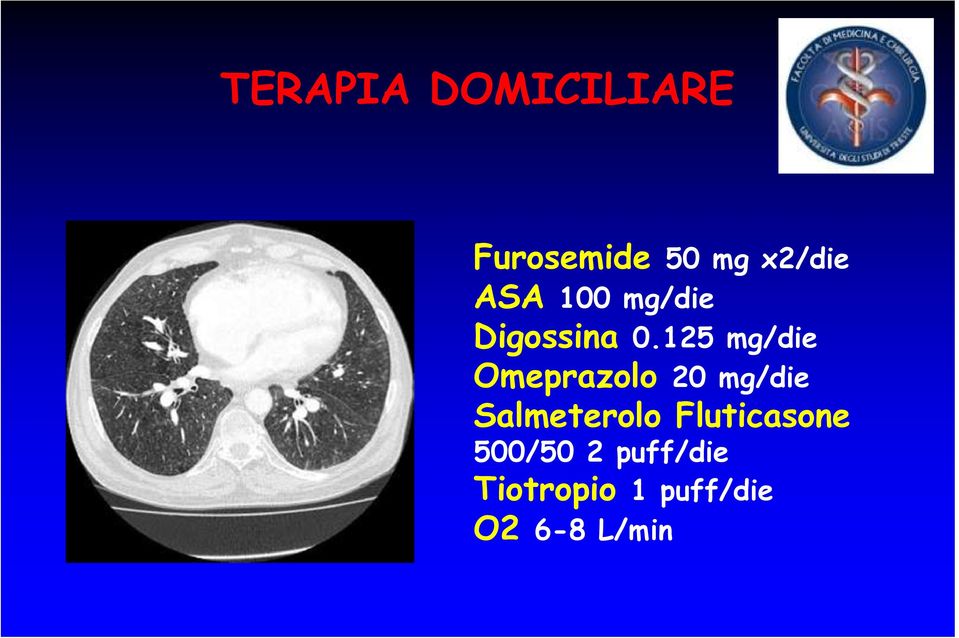 125 mg/die Omeprazolo 20 mg/die Salmeterolo