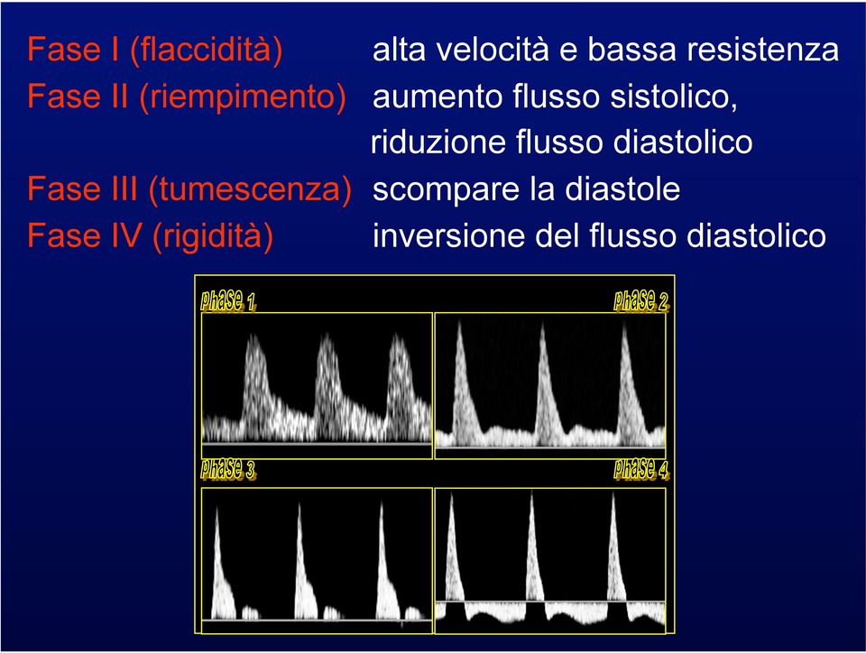 riduzione flusso diastolico Fase III (tumescenza)