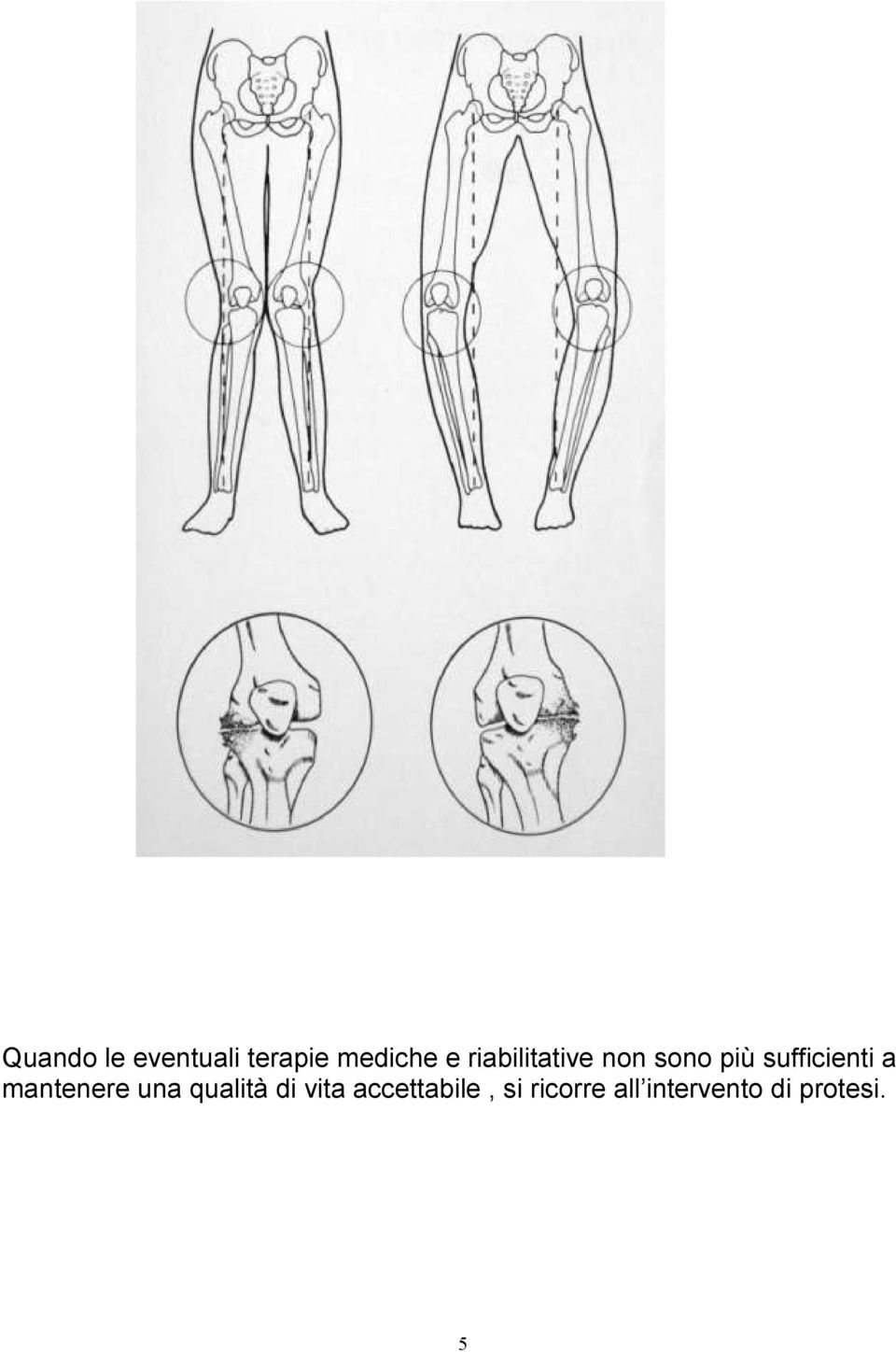 mantenere una qualità di vita