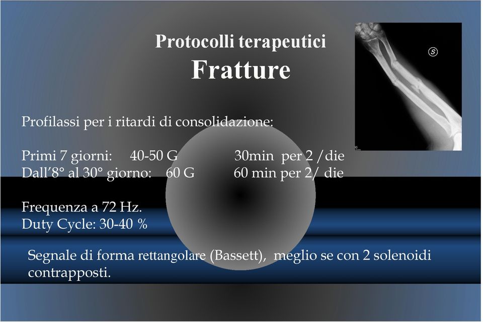 2/ die Frequenza a 72 Hz.