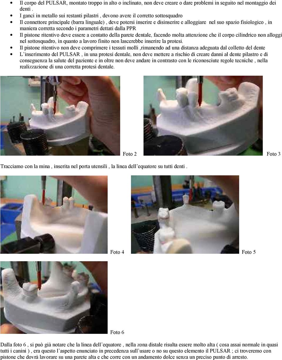 in maniera corretta secondo i parametri dettati dalla PPR Il pistone ritentivo deve essere a contatto della parete dentale, facendo molta attenzione che il corpo cilindrico non alloggi nel