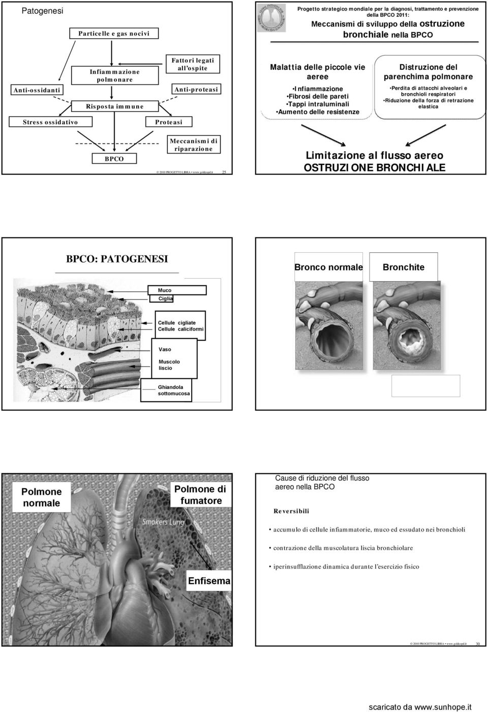 intraluminali Aumento delle resistenze Distruzione del parenchima polmonare Perdita di attacchi alveolari e bronchioli respiratori Riduzione della forza di retrazione elastica BPCO Meccanismi di