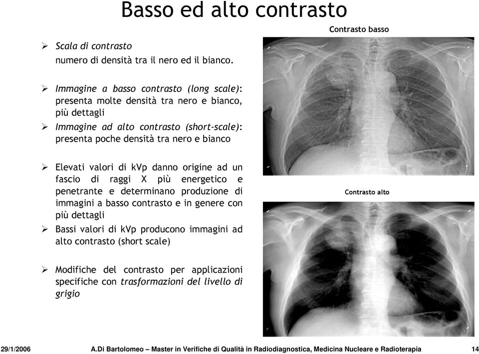 e bianco Elevati valori di kvp danno origine ad un fascio di raggi X più energetico e penetrante e determinano produzione di immagini a basso contrasto e in genere con più dettagli Bassi