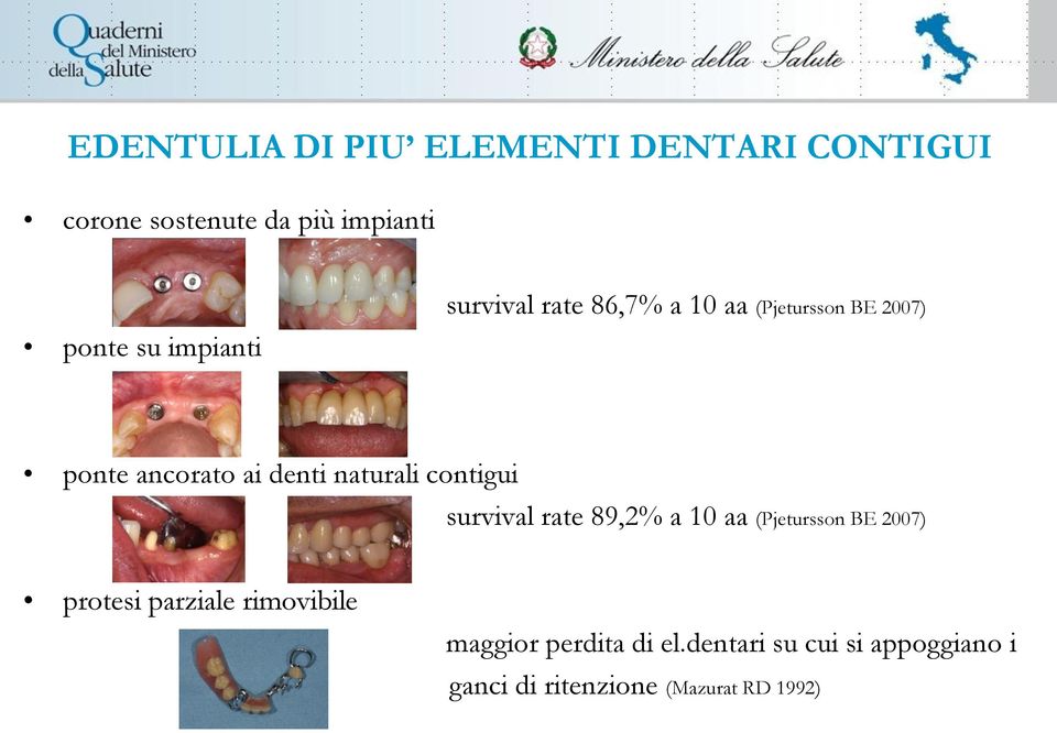 naturali contigui survival rate 89,2% a 10 aa (Pjetursson BE 2007) protesi parziale