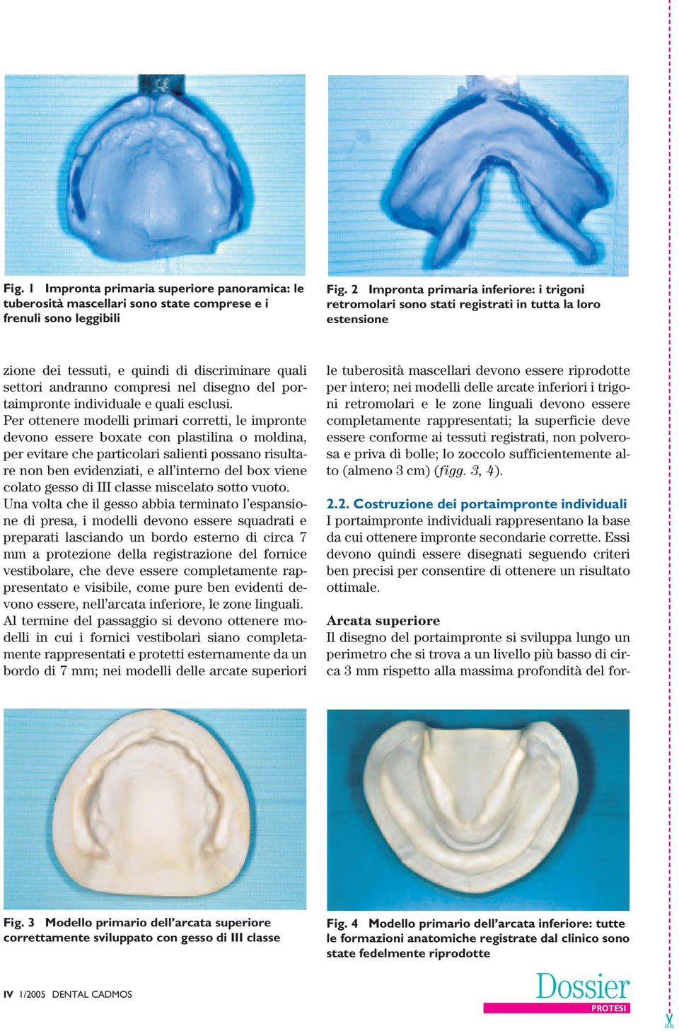 portaimpronte individuale e quali esclusi.