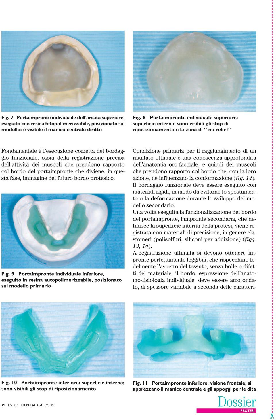 registrazione precisa dell attività dei muscoli che prendono rapporto col bordo del portaimpronte che diviene, in questa fase, immagine del futuro bordo protesico. Fig.