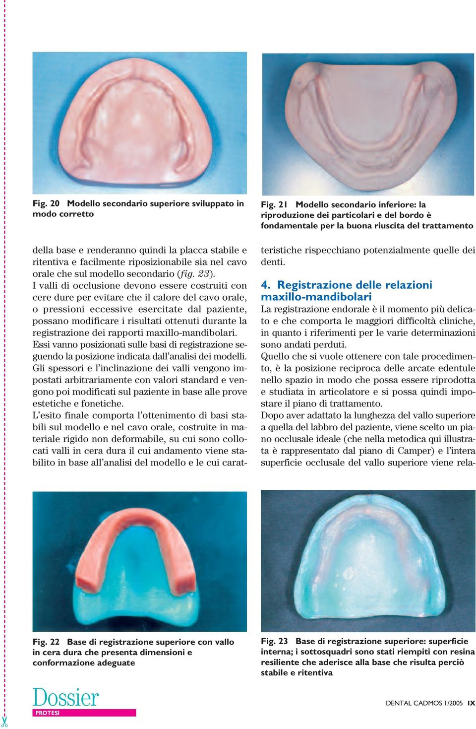 facilmente riposizionabile sia nel cavo orale che sul modello secondario (fig. 23).