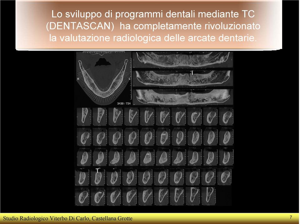 valutazione radiologica delle arcate dentarie.