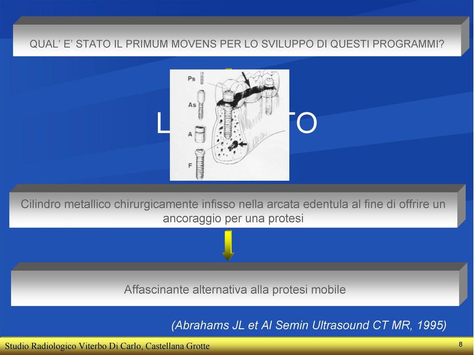 di offrire un ancoraggio per una protesi Affascinante alternativa alla protesi mobile