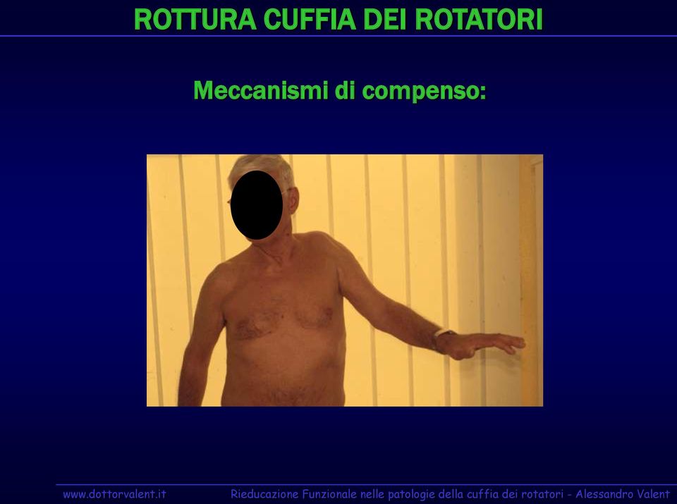 ROTATORI