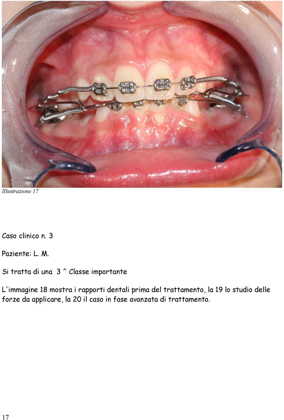 i rapporti dentali prima del trattamento, la 19 lo studio