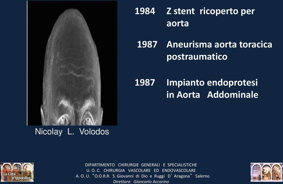 endoprotesi in Aorta Addominale Nicolay L.