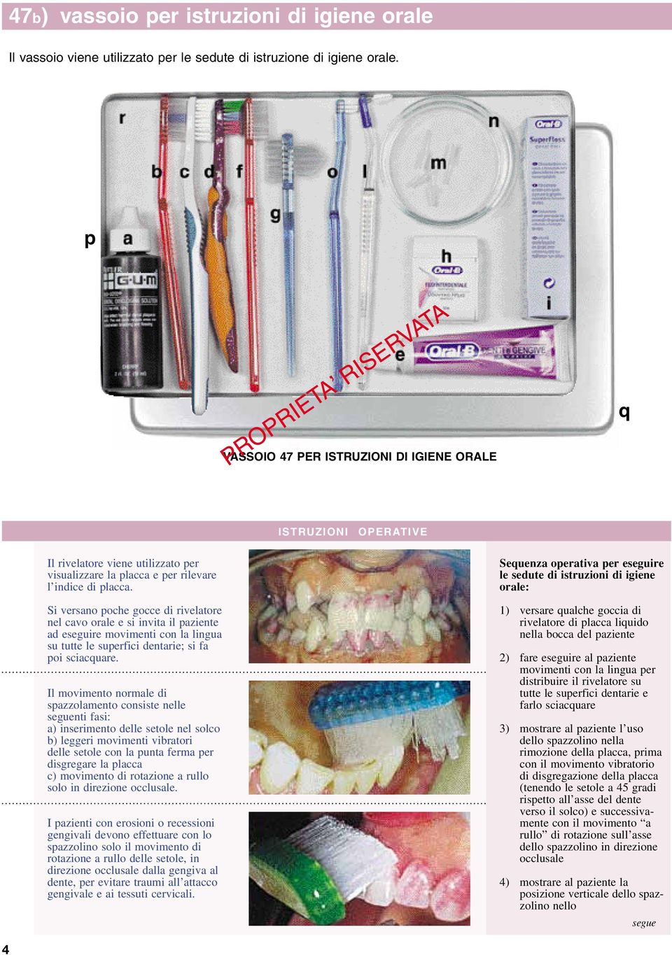 Si versano poche gocce di rivelatore nel cavo orale e si invita il paziente ad eseguire movimenti con la lingua su tutte le superfici dentarie; si fa poi sciacquare.