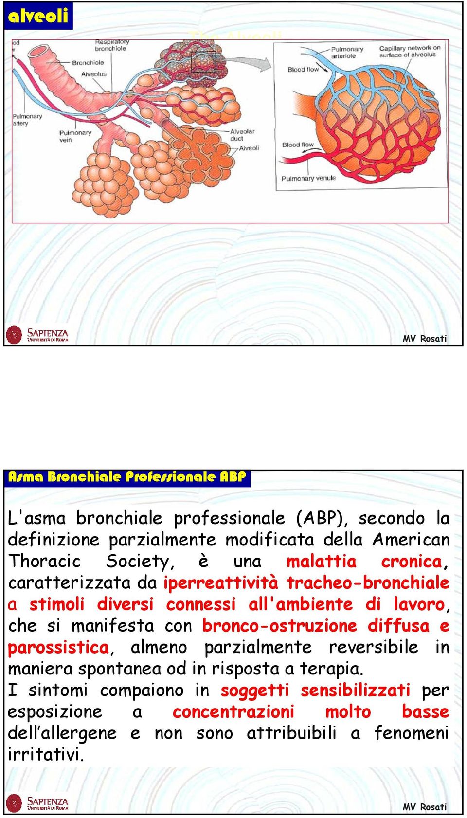 lavoro, che si manifesta con bronco-ostruzione diffusa e parossistica, almeno parzialmente reversibile in maniera spontanea od in risposta a terapia.