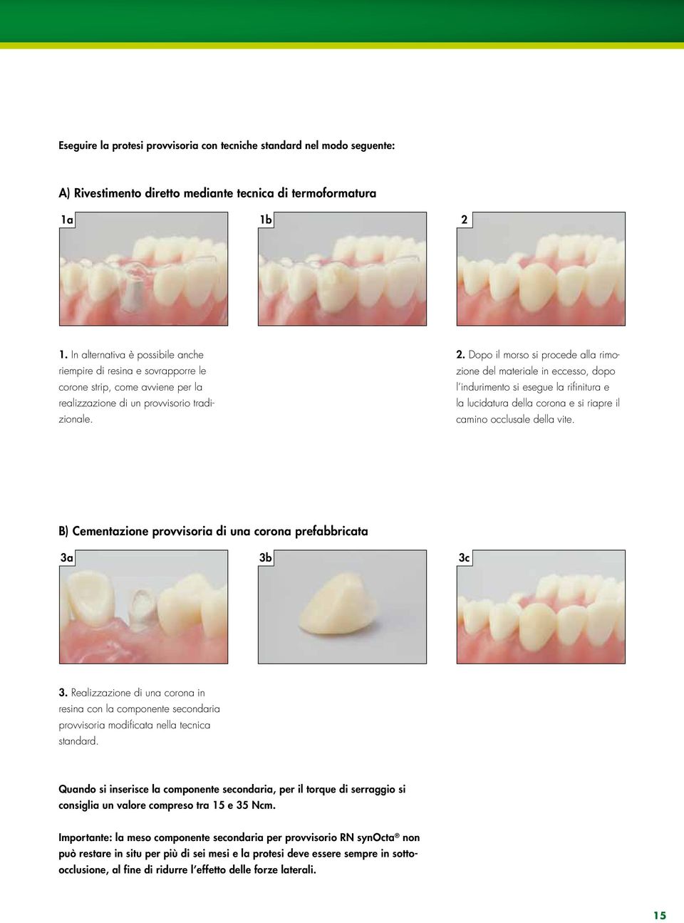 Dopo il morso si procede alla rimozione del materiale in eccesso, dopo l indurimento si esegue la rifinitura e la lucidatura della corona e si riapre il camino occlusale della vite.