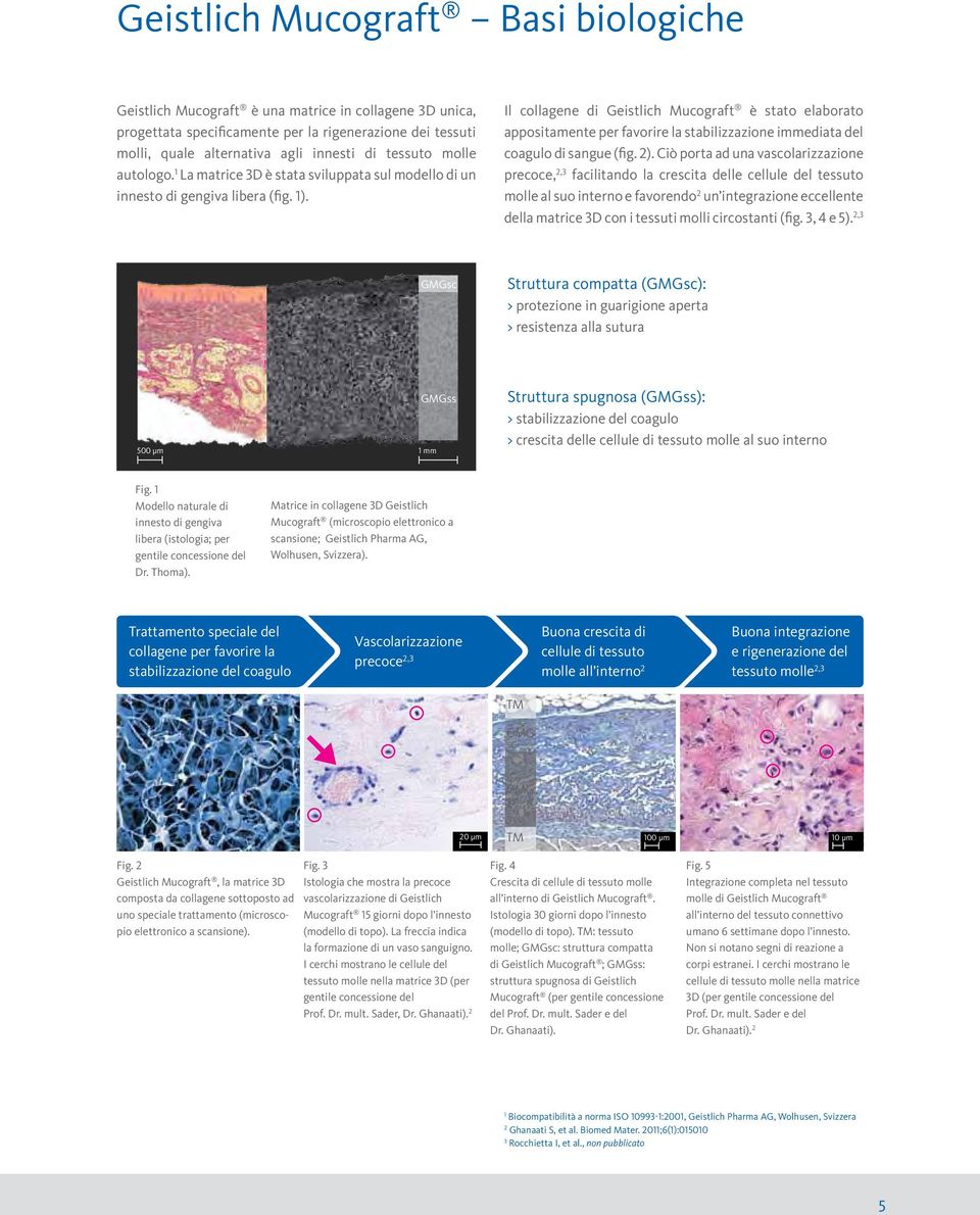 Il collagene di Geistlich Mucograft è stato elaborato appositamente per favorire la stabilizzazione immediata del coagulo di sangue (fig. 2).