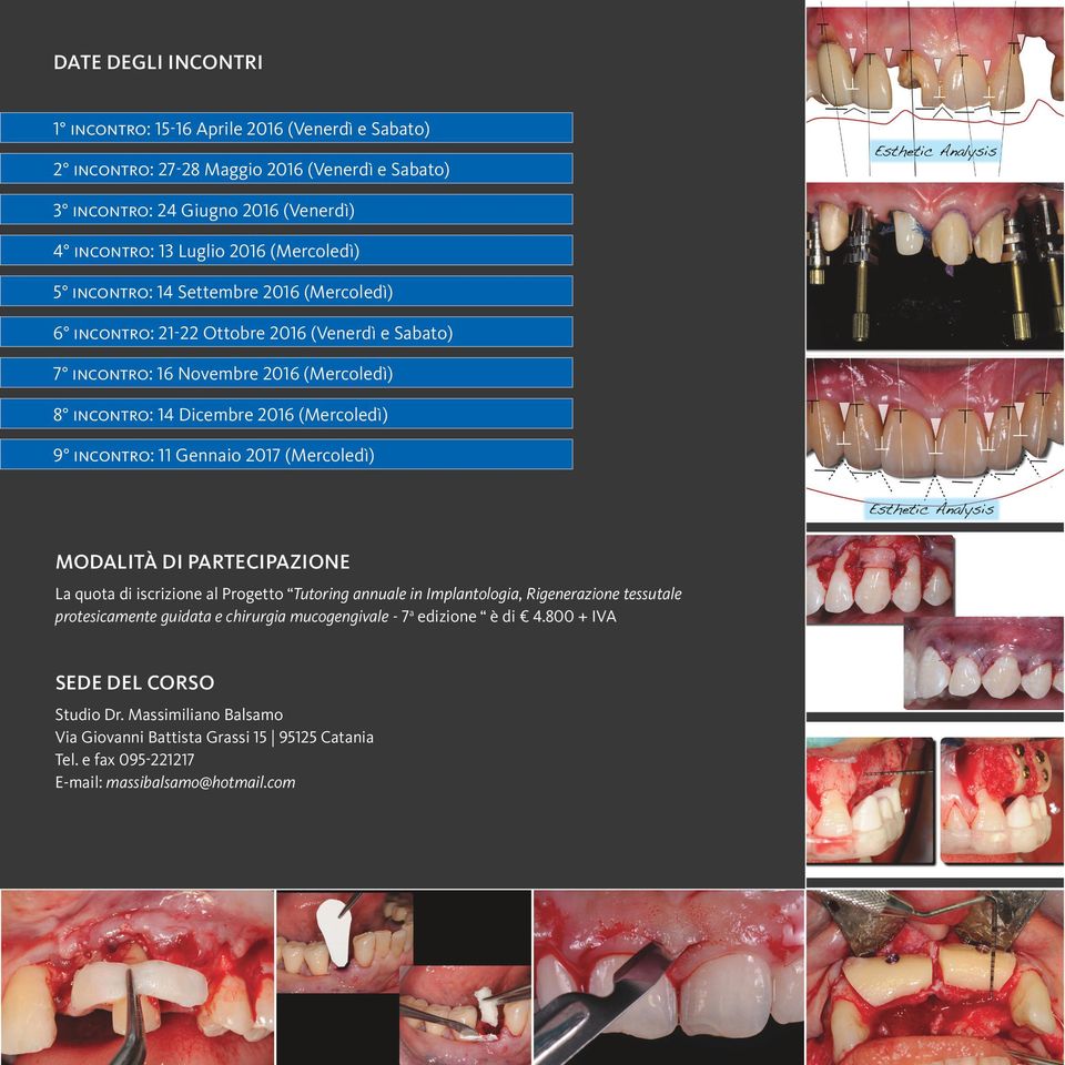 incontro: 11 Gennaio 2017 (Mercoledì) MODALITÀ DI PARTECIPAZIONE La quota di iscrizione al Progetto Tutoring annuale in Implantologia, Rigenerazione tessutale protesicamente guidata e