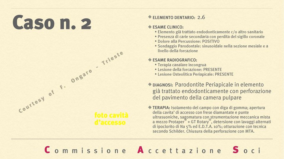 sezione mesiale e a livello della forcazione Terapia canalare incongrua Lesione della forcazione: PRESENTE Lesione Osteolitica Periapicale: PRESENTE DIAGNOSI: Parodontite Periapicale in elemento già