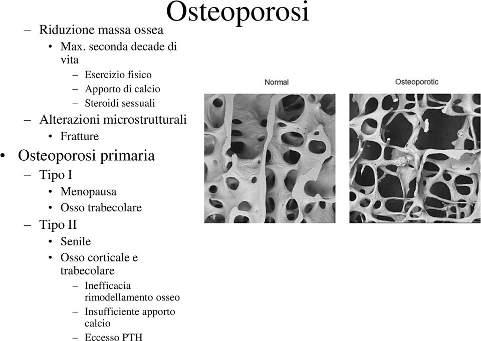 Alterazioni microstrutturali Fratture Osteoporosi primaria Tipo I Menopausa Osso