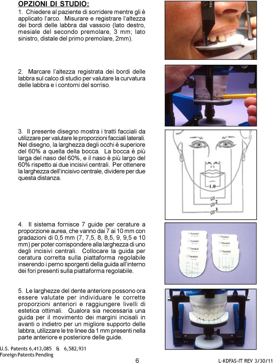 m). 2. Marcare l altezza registrata dei bordi delle labbra sul calco di studio per valutare la curvatura delle labbra e i contorni del sorriso. 3.