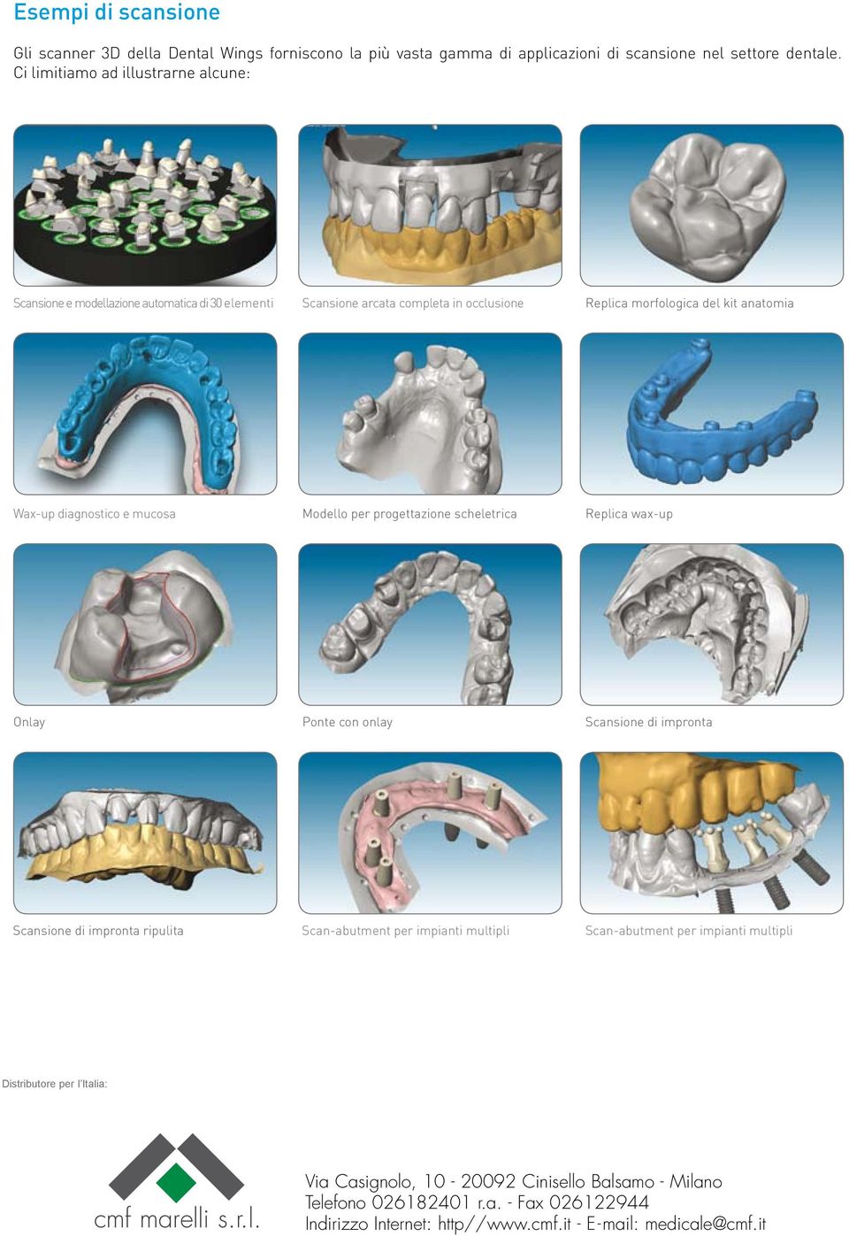 diagnostico e mucosa Modello per progettazione scheletrica Replica wax-up Onlay Ponte con onlay Scansione di impronta Scansione di impronta ripulita Scan-abutment per impianti