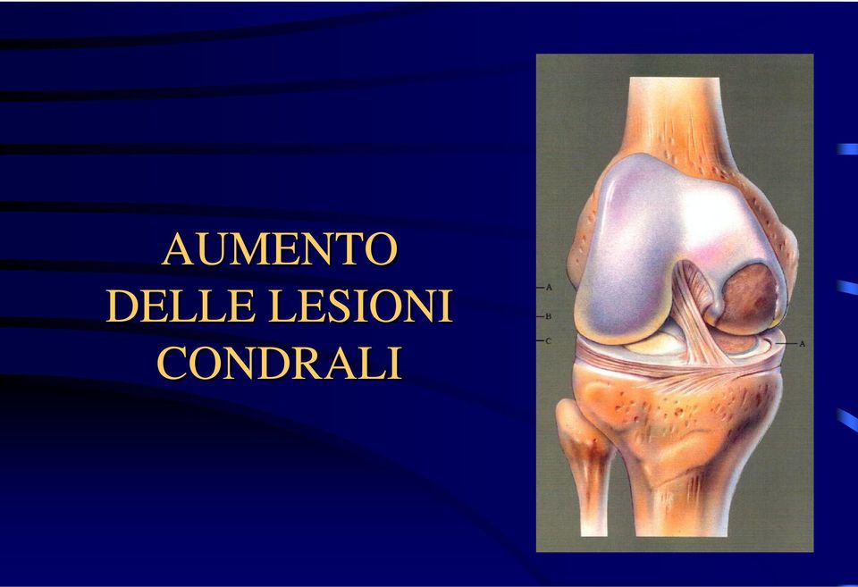 LESIONI