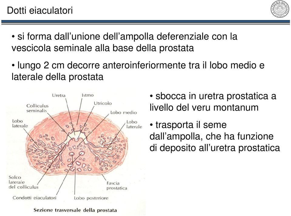 lobo medio e laterale della prostata sbocca in uretra prostatica a livello del veru