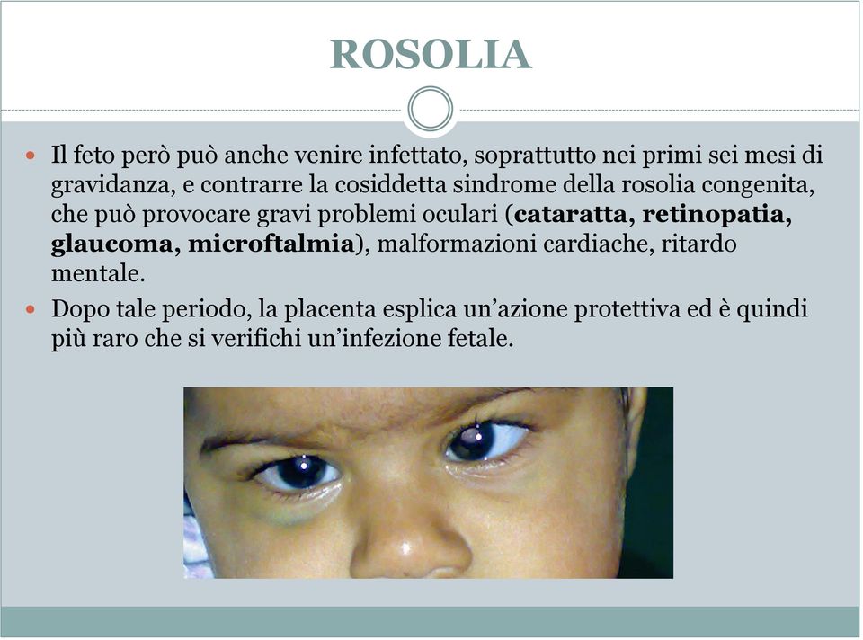 (cataratta, retinopatia, glaucoma, microftalmia), malformazioni cardiache, ritardo mentale.