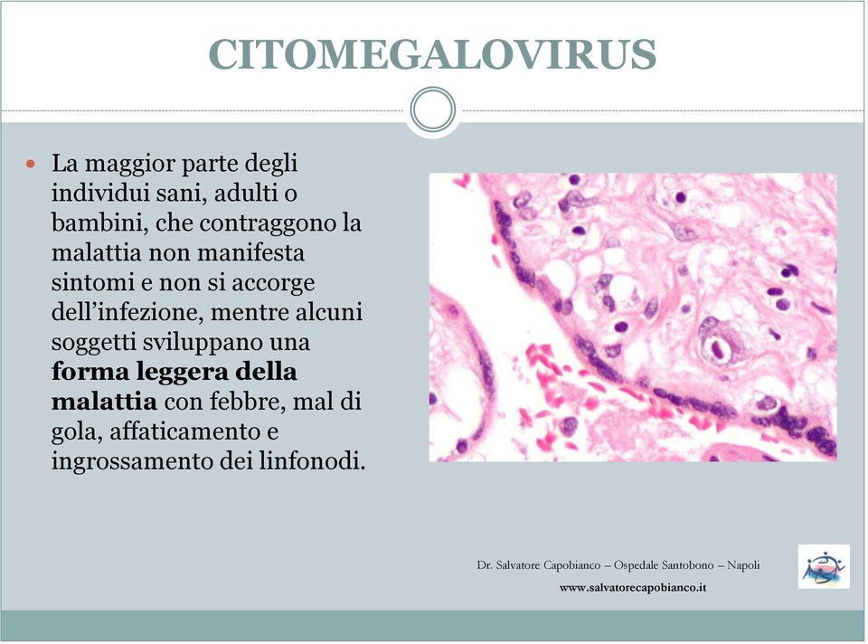 infezione, mentre alcuni soggetti sviluppano una forma leggera della