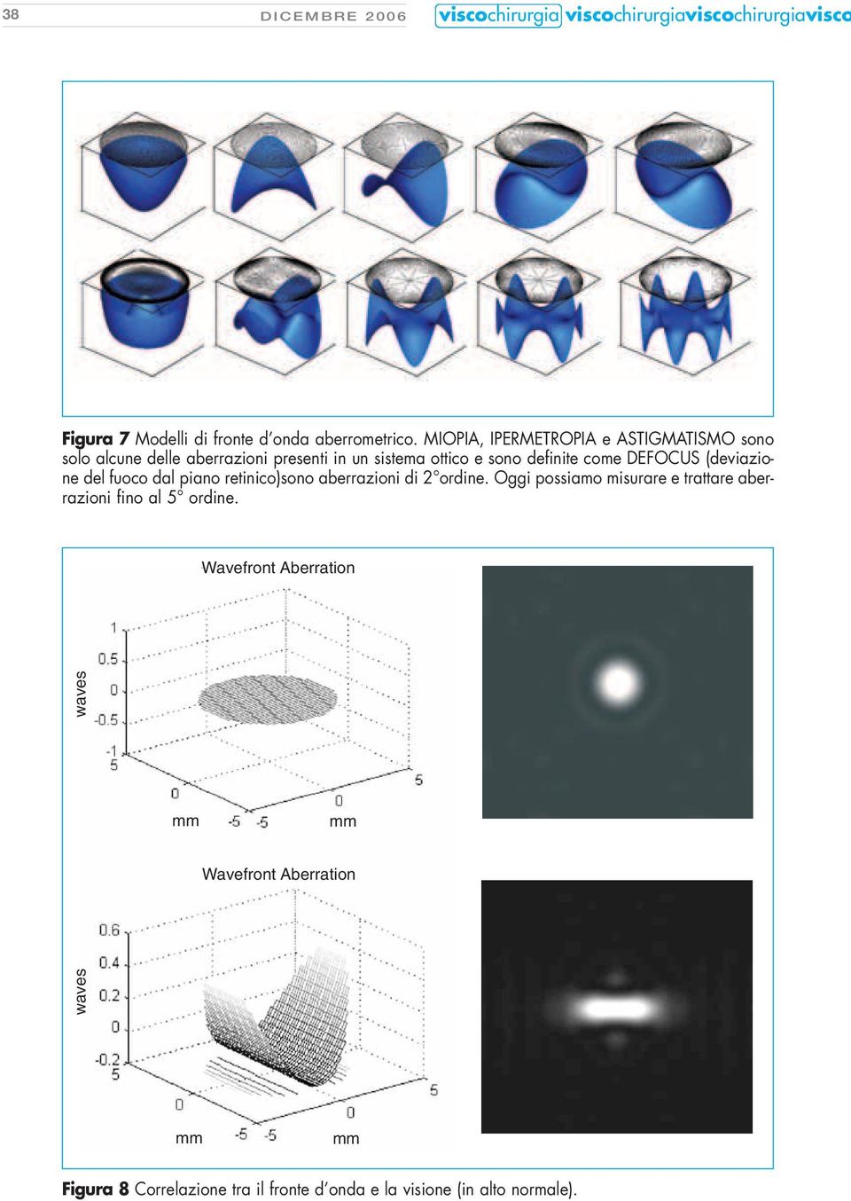 (deviazione del fuoco dal piano retinico)sono aberrazioni di 2 ordine.