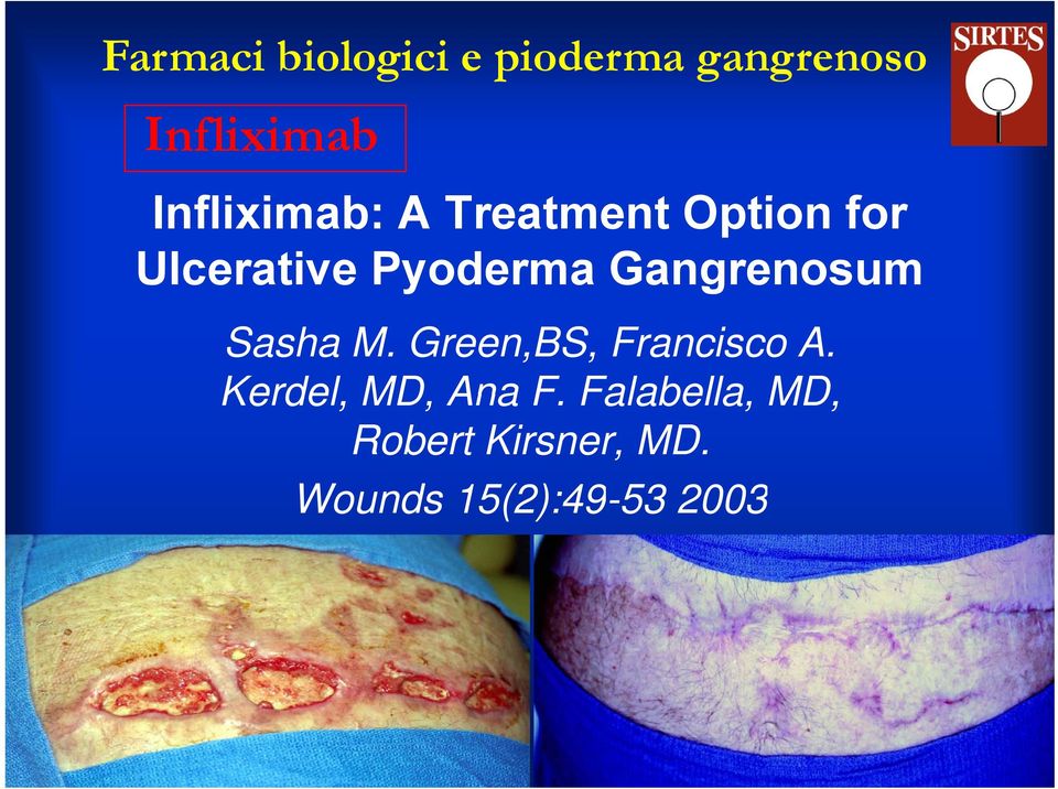 Gangrenosum Sasha M. Green,BS, Francisco A.