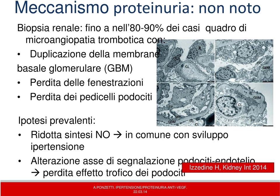 pedicelli podociti Ipotesi prevalenti: Ridotta sintesi NO in comune con sviluppo ipertensione