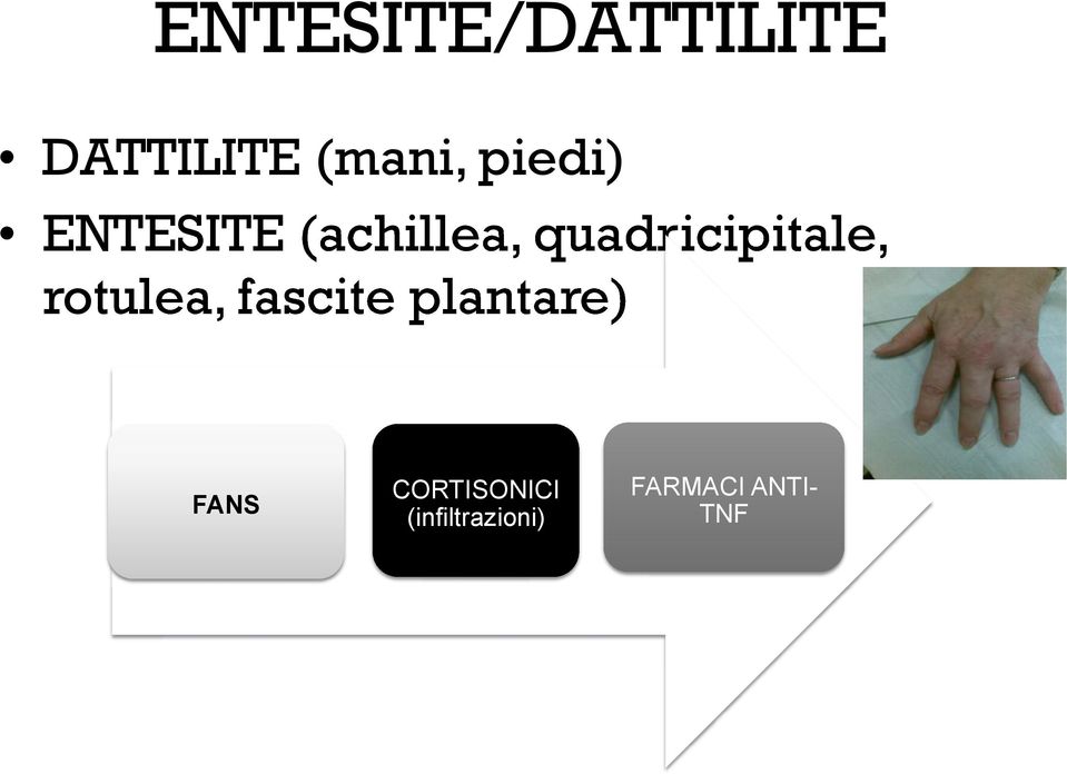 ENTESITE (achillea, quadricipitale,