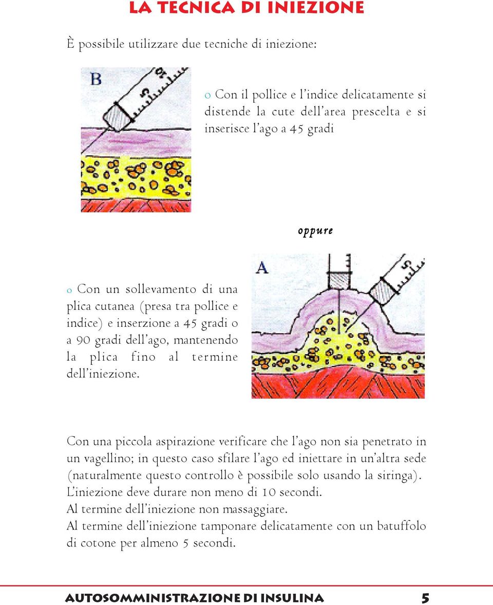 Con una piccola aspirazione verificare che l ago non sia penetrato in un vagellino; in questo caso sfilare l ago ed iniettare in un altra sede (naturalmente questo controllo è possibile solo usando