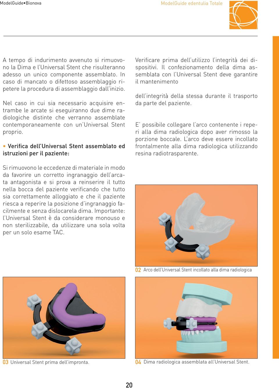 Nel caso in cui sia necessario acquisire entrambe le arcate si eseguiranno due dime radiologiche distinte che verranno assemblate contemporaneamente con un Universal Stent proprio.