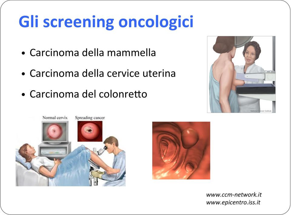 cervice uterina Carcinoma del