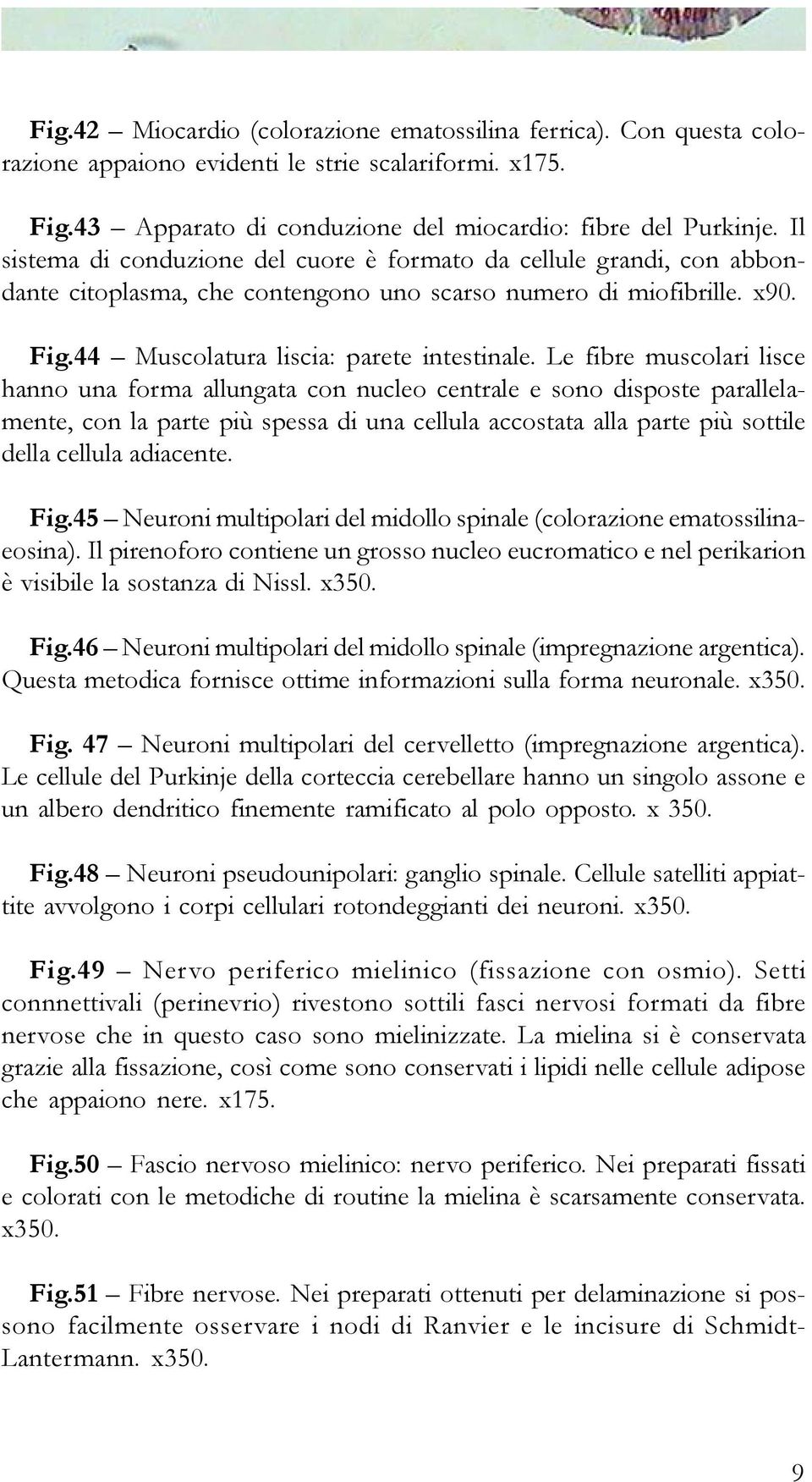 Le fibre muscolari lisce hanno una forma allungata con nucleo centrale e sono disposte parallelamente, con la parte più spessa di una cellula accostata alla parte più sottile della cellula adiacente.