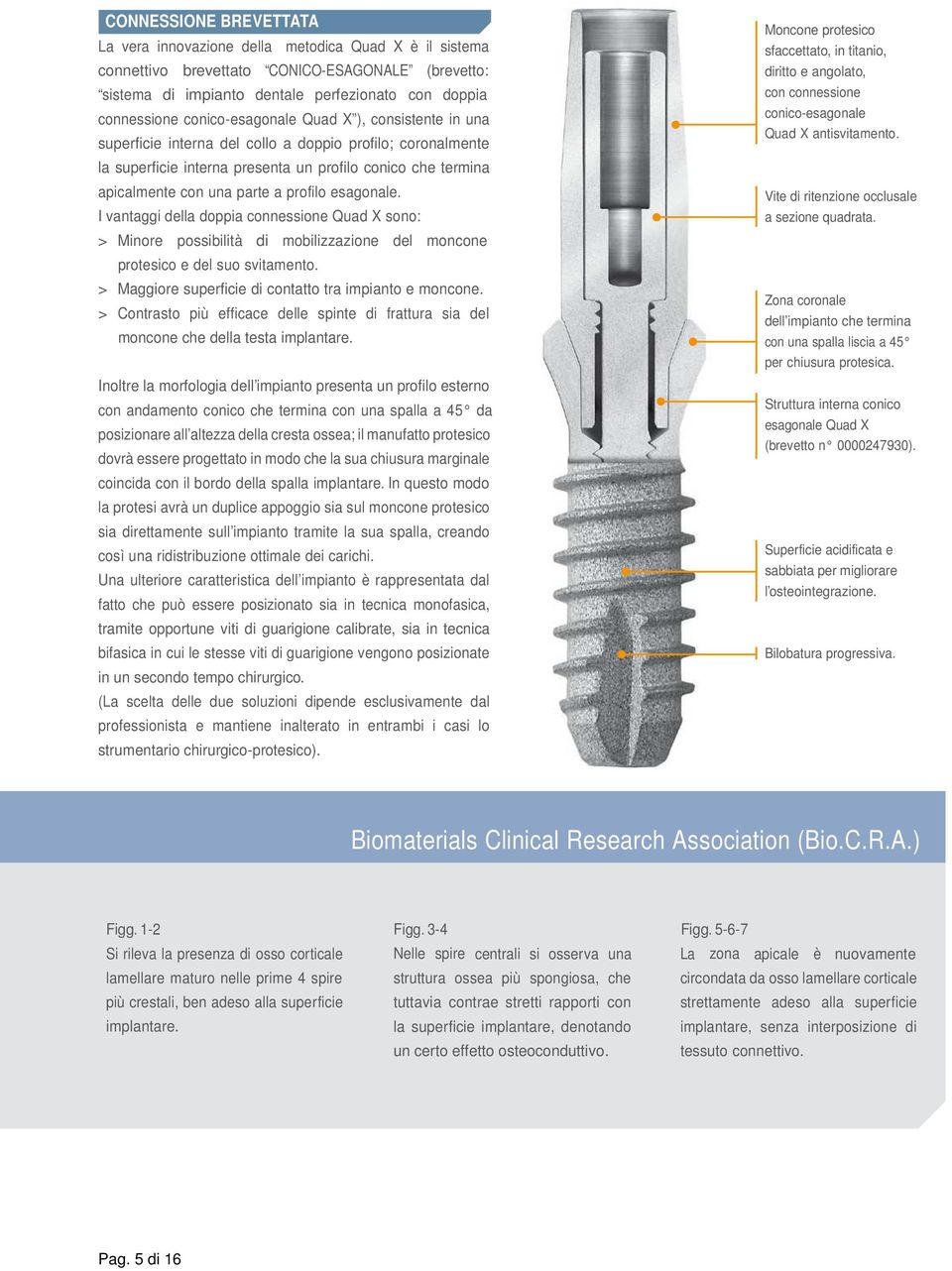 profilo esagonale. I vantaggi della doppia connessione Quad X sono: > Minore possibilità di mobilizzazione del moncone protesico e del suo svitamento.