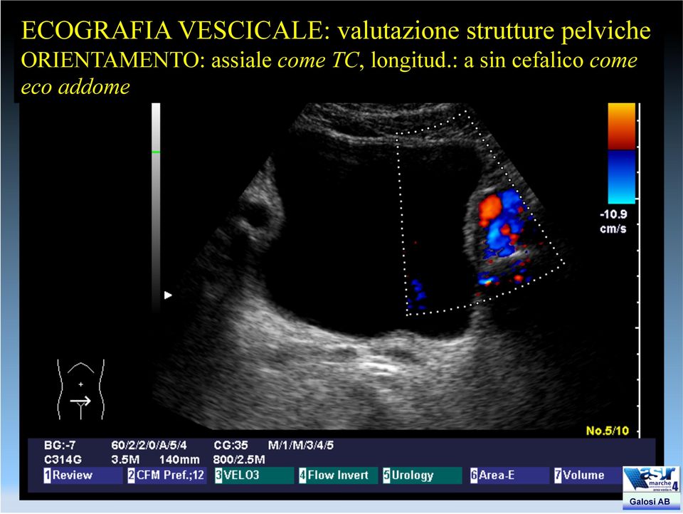 ORIENTAMENTO: assiale come TC,