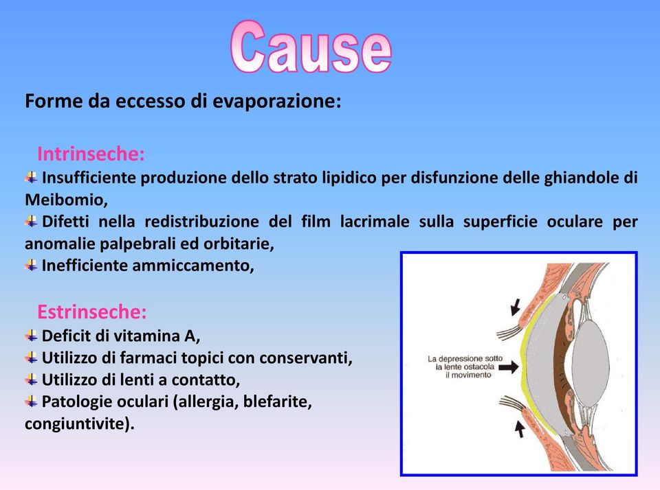 anomalie palpebrali ed orbitarie, Inefficiente ammiccamento, Estrinseche: Deficit di vitamina A, Utilizzo di