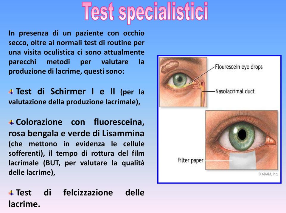 produzione lacrimale), Colorazione con fluoresceina, rosa bengala e verde di Lisammina (che mettono in evidenza le cellule