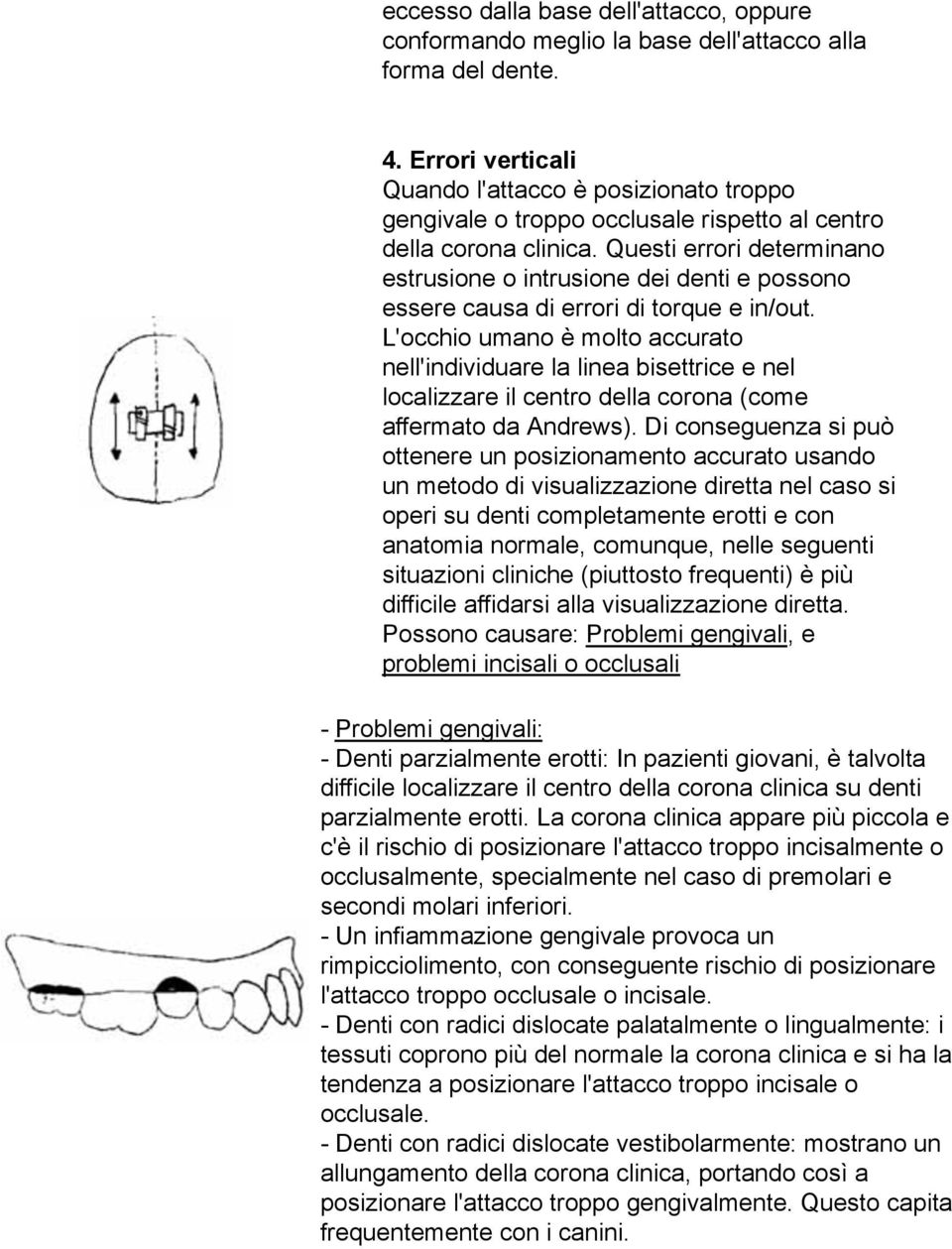 Questi errori determinano estrusione o intrusione dei denti e possono essere causa di errori di torque e in/out.