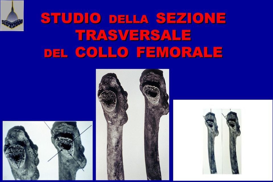 TRASVERSALE