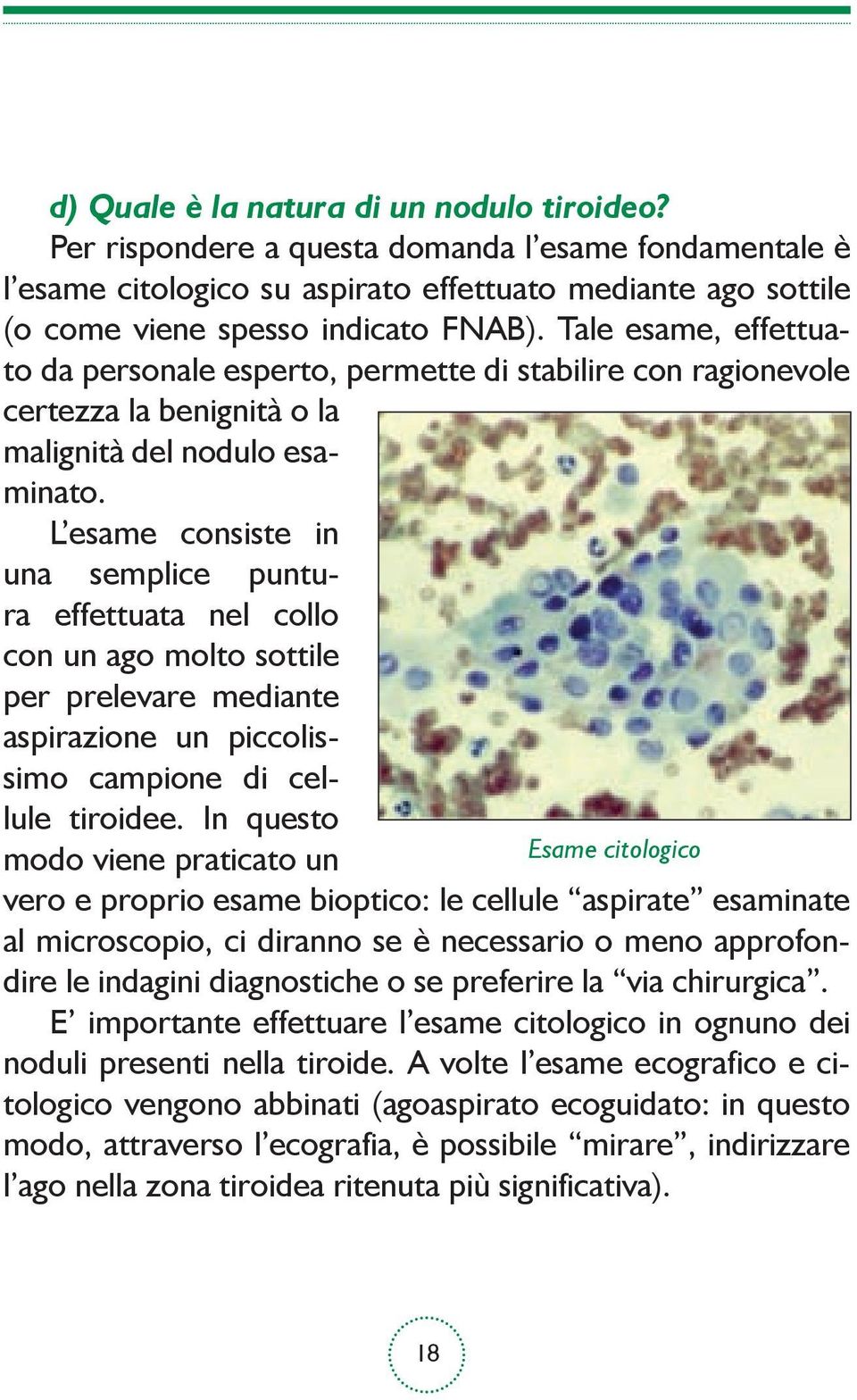 L esame consiste in una semplice puntura effettuata nel collo con un ago molto sottile per prelevare mediante aspirazione un piccolissimo campione di cellule tiroidee.